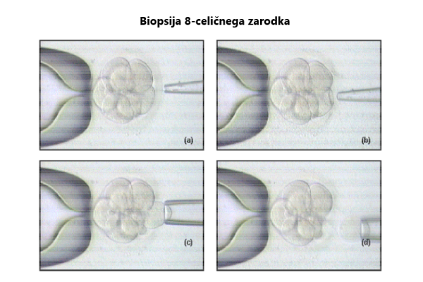 Biopsija_zarodka